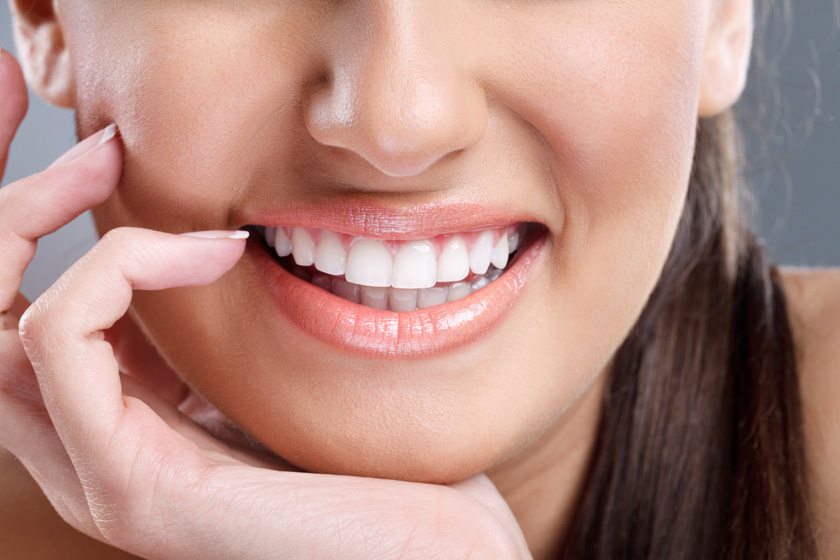 Hollywood Smile (Gülüş Estetiği)